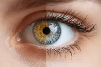 Iridology as a Portal Exploring the Spiritual Map Within Your Iris